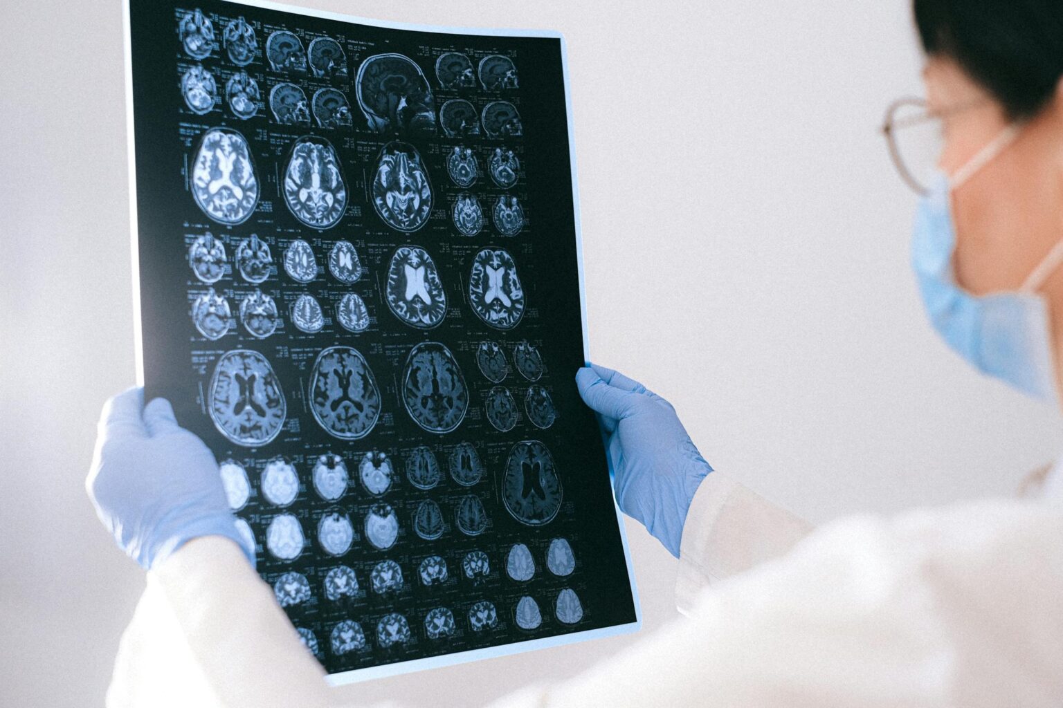 Doctor holds up MRI scans of the brain.