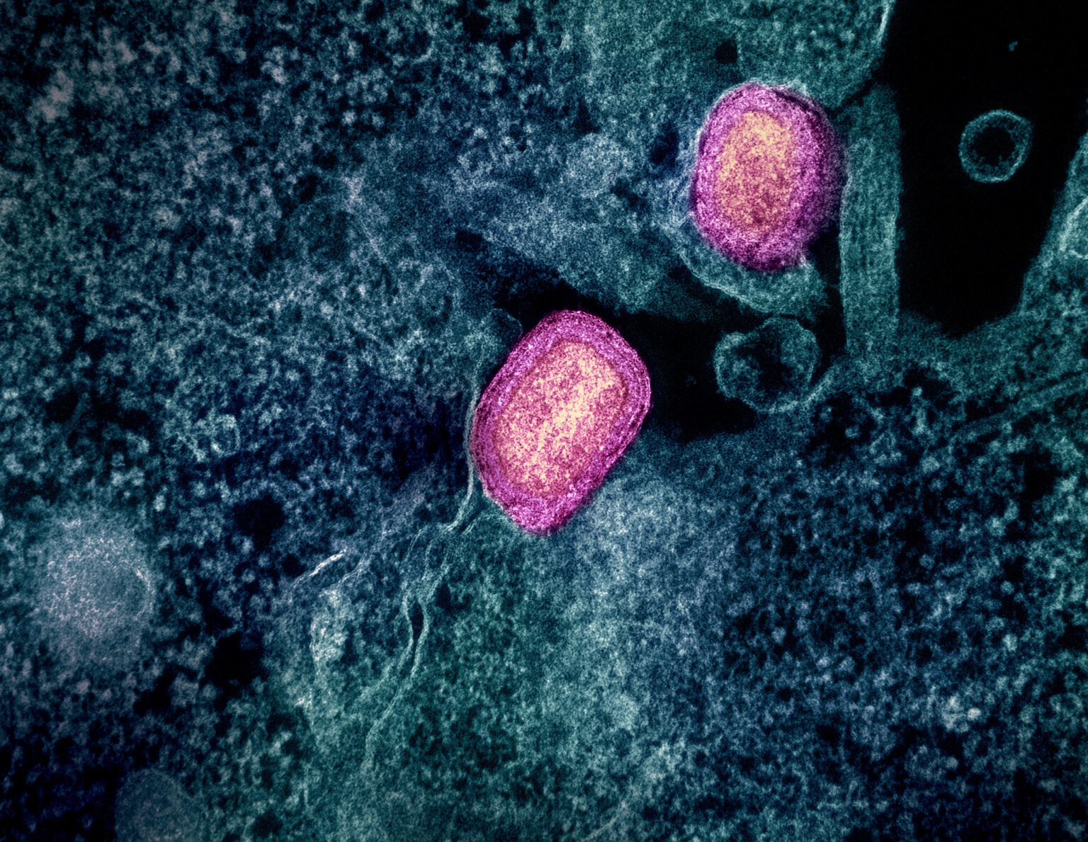 Monkeypox (Mpox) Virus Colorized transmission electron micrograph of two mature mpox virus particles (pink) attached to the surface of an infected VERO E6 cell (blue/teal). Image captured at the NIAID Integrated Research Facility in Fort Detrick, Maryland.