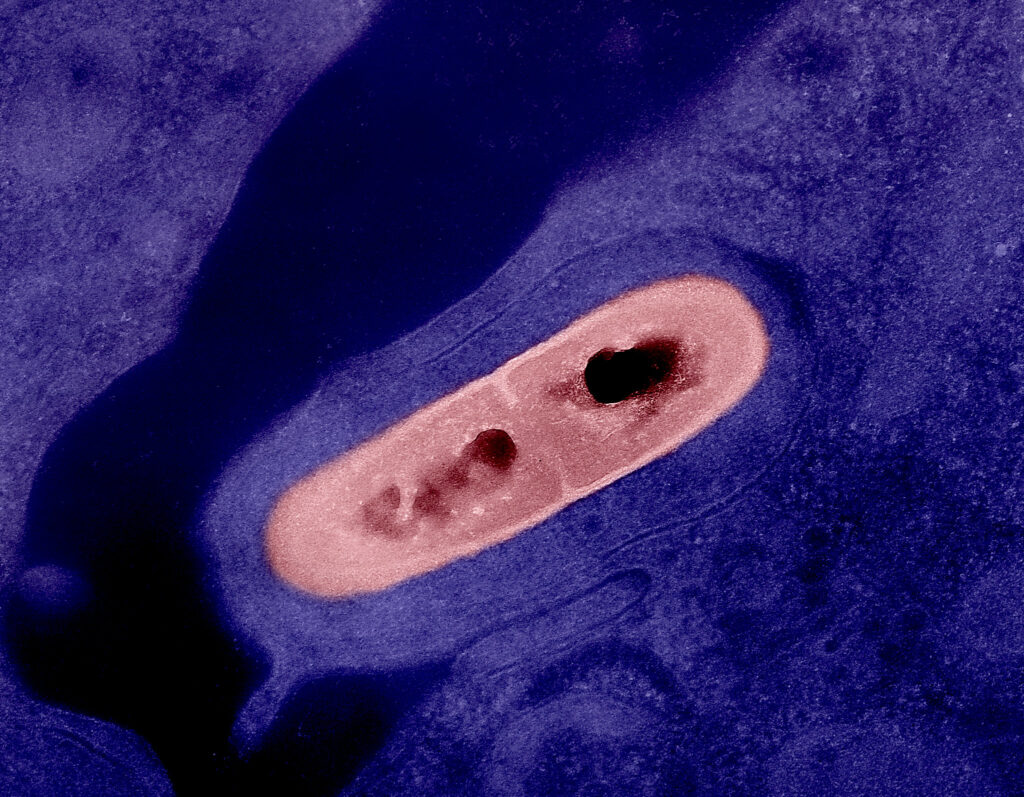 image of a colorized close up of bacteria listeria